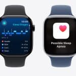 Two Apple Watches: one displays a sleep stages graph, the other shows a ‘Possible Sleep Apnea’ alert.
